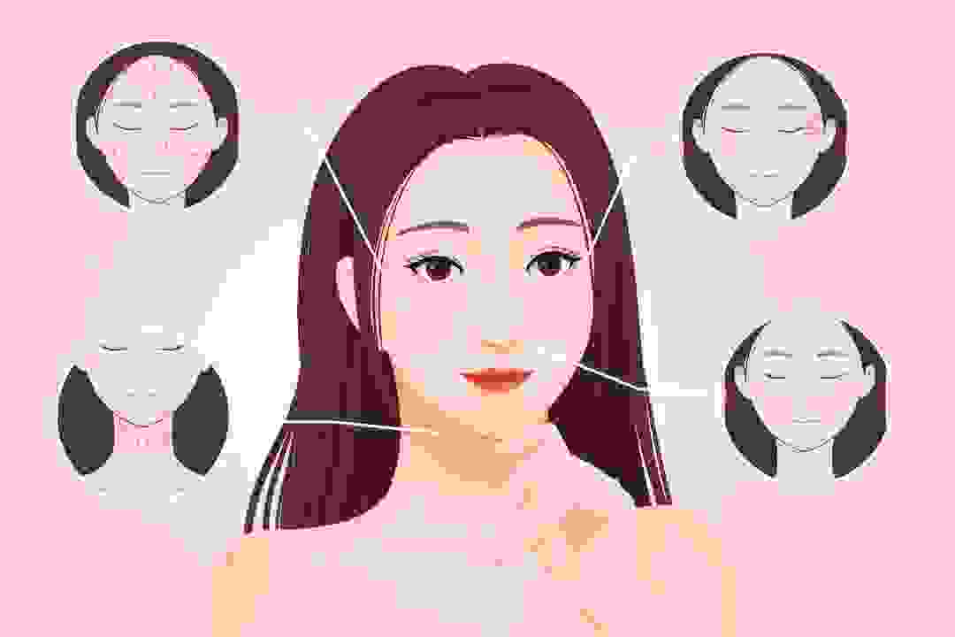 الاتجاه العام لـ "الجمال الطبي الخفيف" ، حمض الهيالورونيك يحتل نصف البلاد! : -4