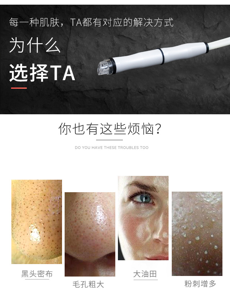 韩国进口小气泡一代 : -2