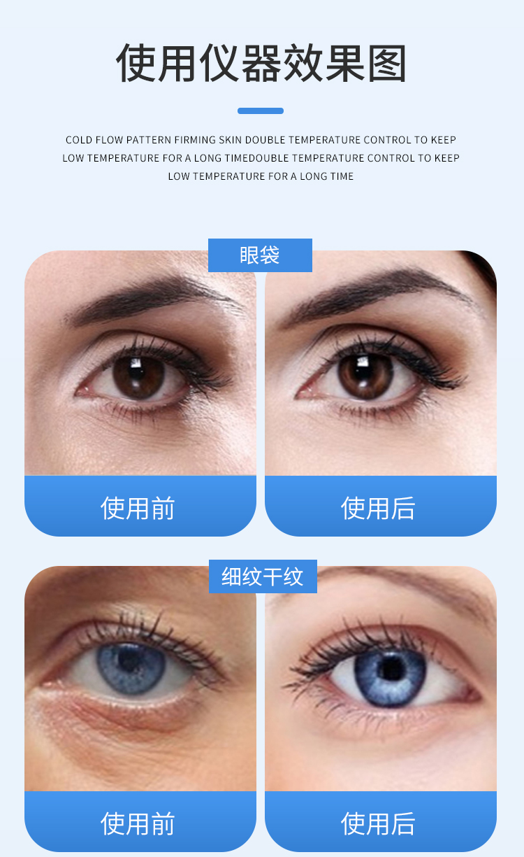 عداد سكر ياباني: -9 عداد سكر ياباني: -9