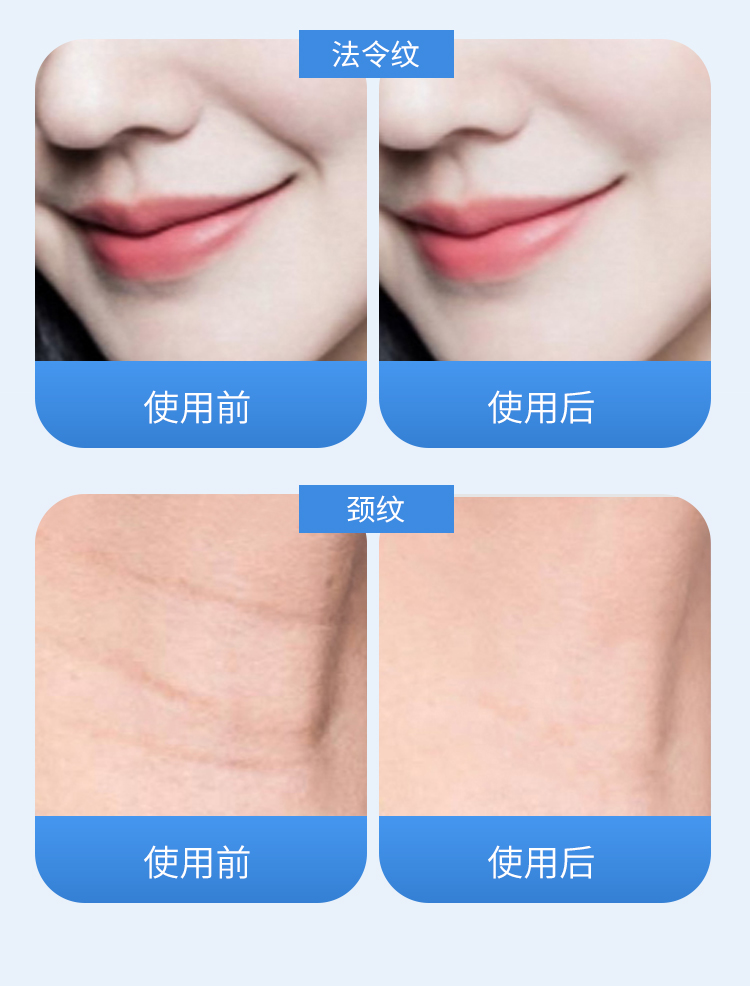 عداد سكر ياباني: -10 عداد سكر ياباني: -10