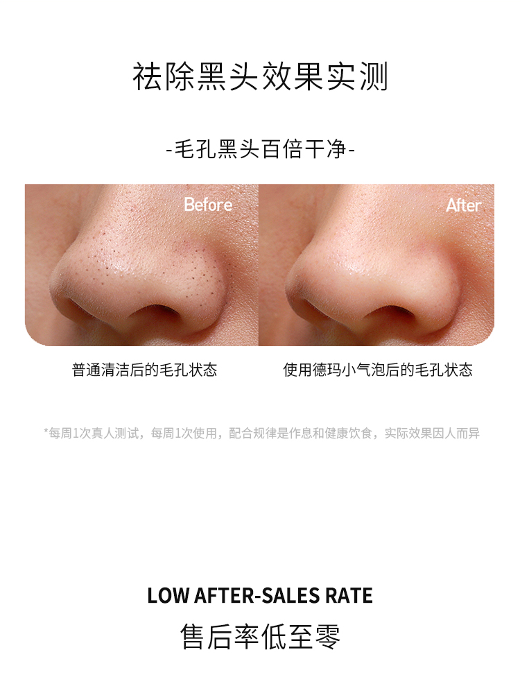 德玛贝尔小气泡清洁仪 : -4